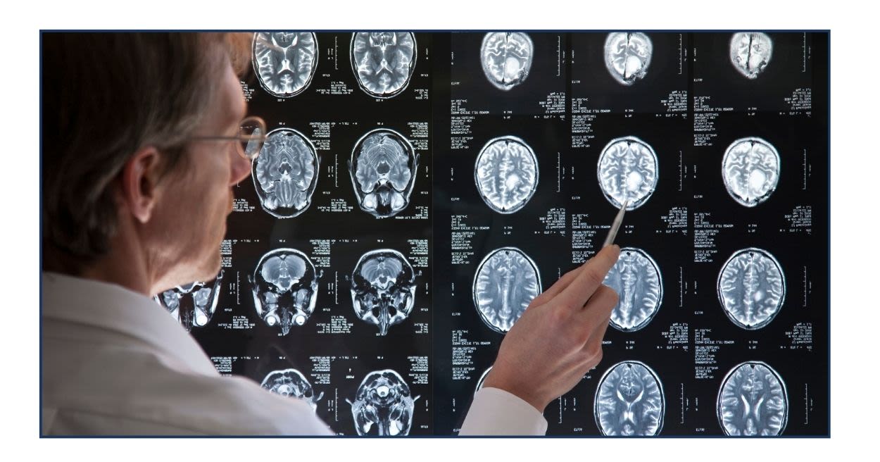 Medical professional looking at multiple images of a brain scan